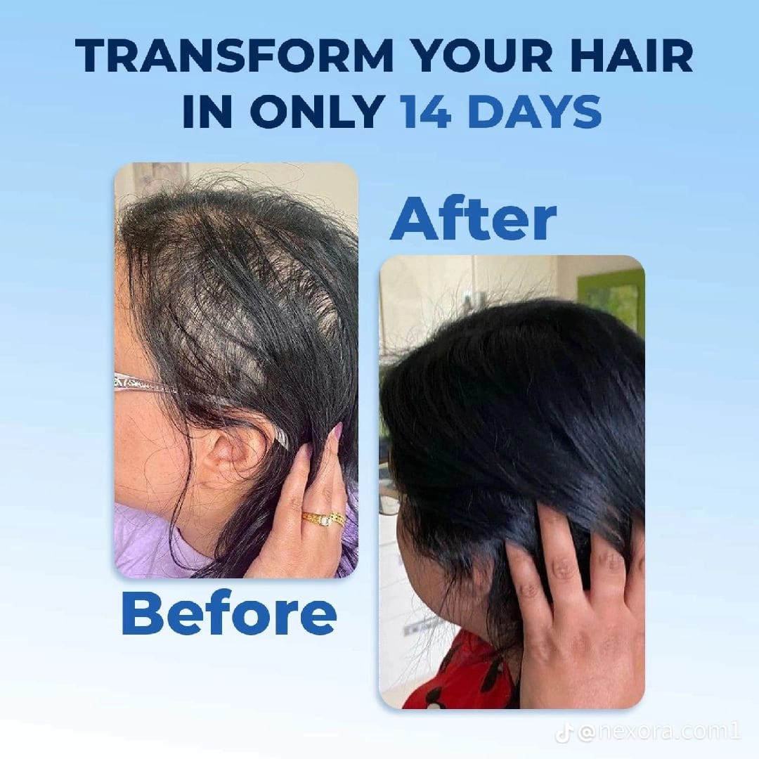 FEG Plus Hair Growth Spray – With AnaGain™, Procapil & Seaweed Extract