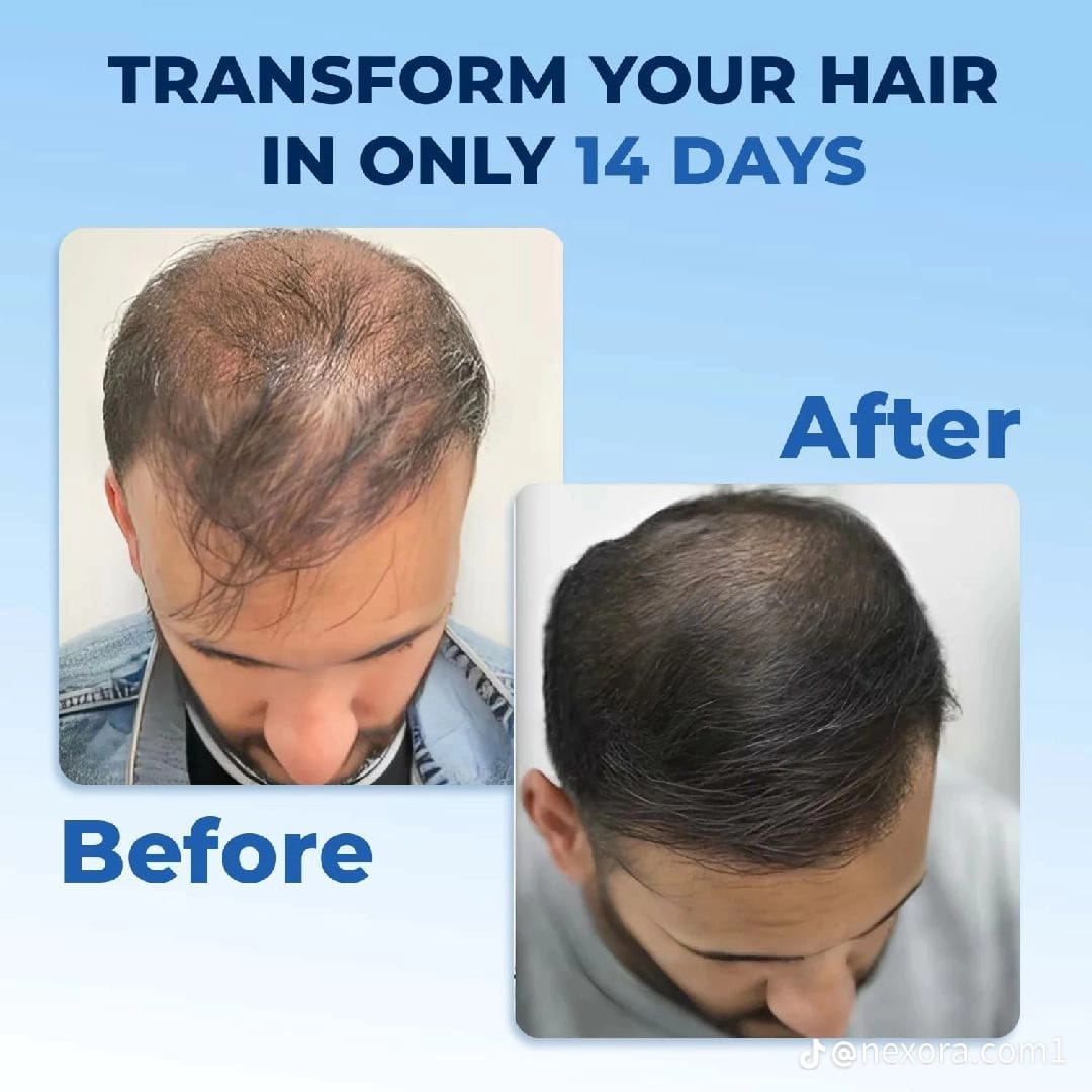 FEG Plus Hair Growth Spray – With AnaGain™, Procapil & Seaweed Extract